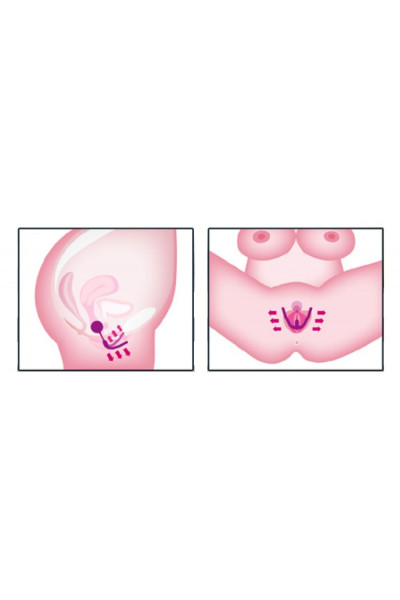 Тренажер интимных мышц Intimate Spreader Pussy Gym Тренажер интимных мышц Intimate Spreader Pussy Gym